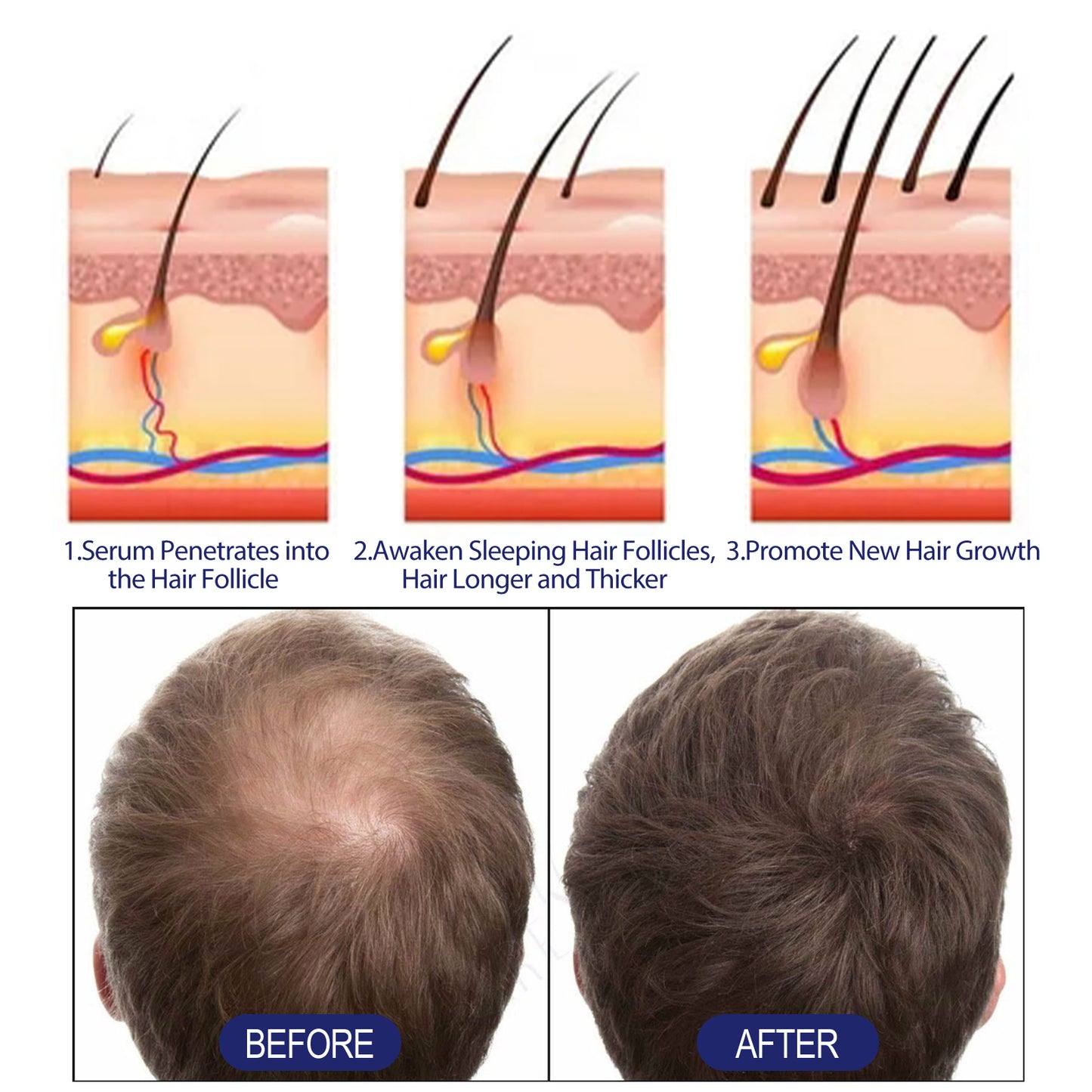 Men's Dense Hair Foam Machine